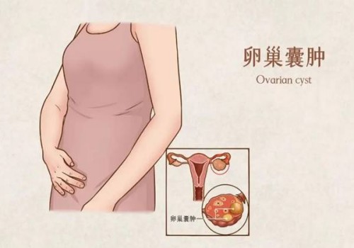 上海代生男孩：﻿2023去俄罗斯不超过20万就能做一次试管婴儿实现生育的梦想